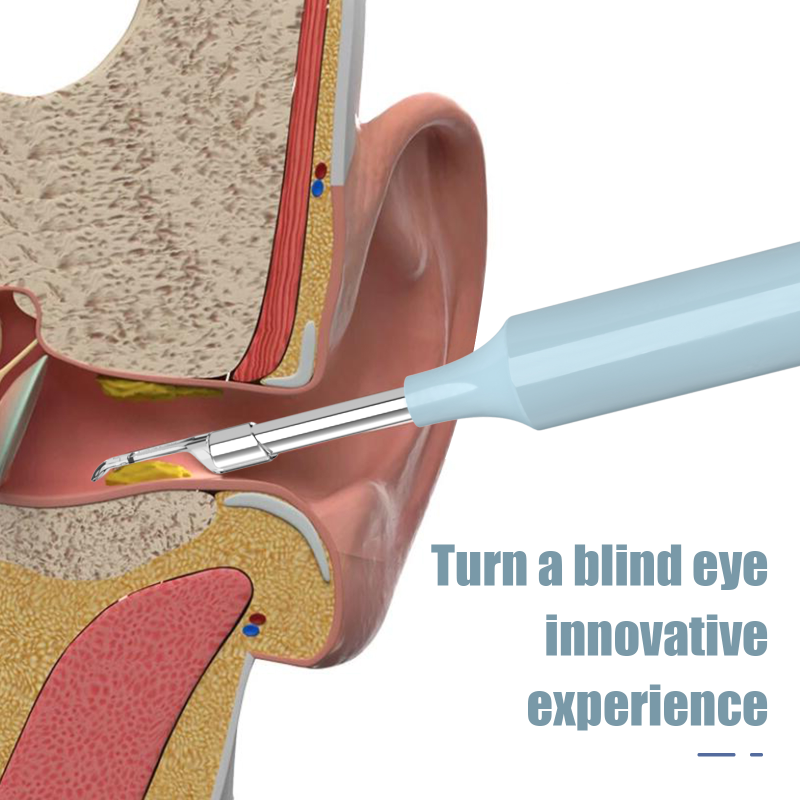 Ear Camera White (smart visual ear otoscope ) - Image 3